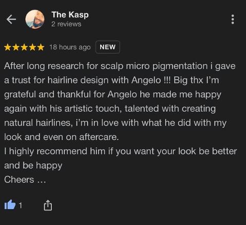 Scalp Micro Pigmentation in Austin review 