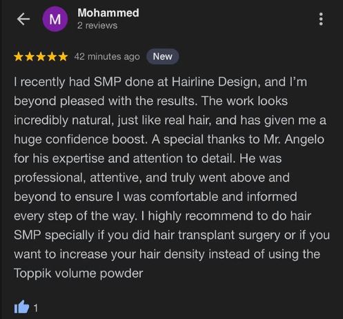 Scalp Micro Pigmentation in Austin review 