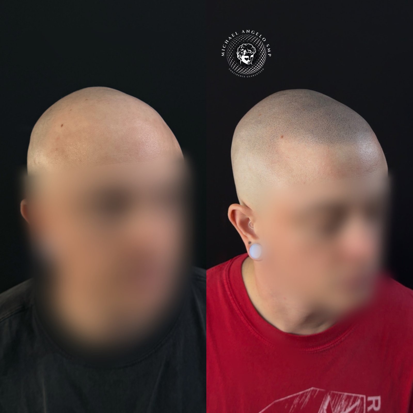 7 Shaved head SMP client transformation