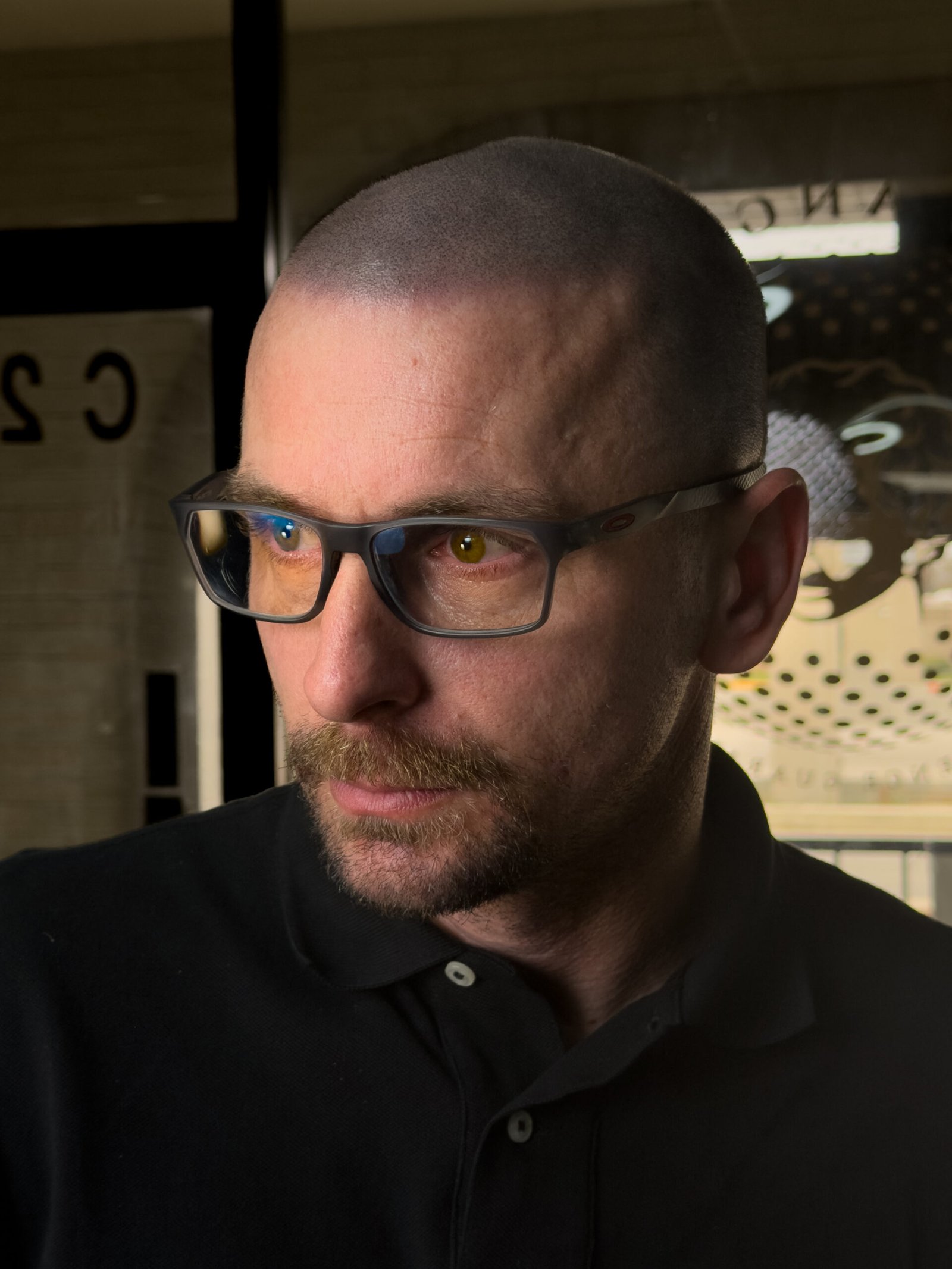 final session · 100%: real client gradual shaved-head scalp micropigmentation at Michael Angelo SMP in Austin, Texas